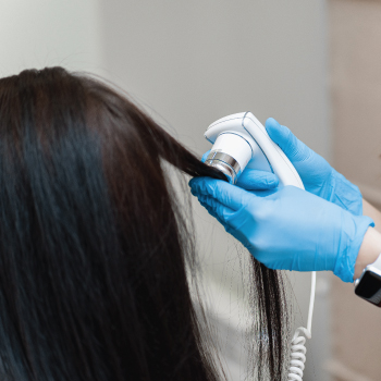 global hair treatment Laser Therapy
