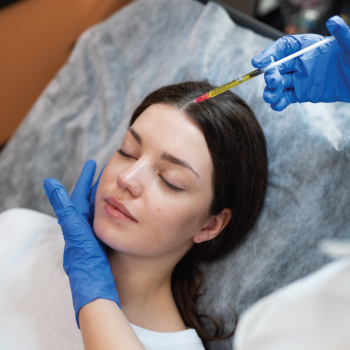 PRP Therapy for Hair Growth